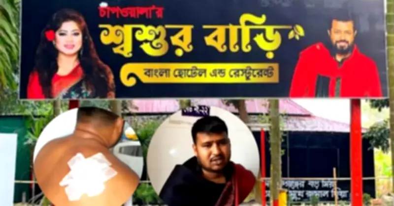 ওমর সানীর রেস্তোরাঁয় হামলা: আহত ১, ১৩ জনের বিরুদ্ধে মামলা