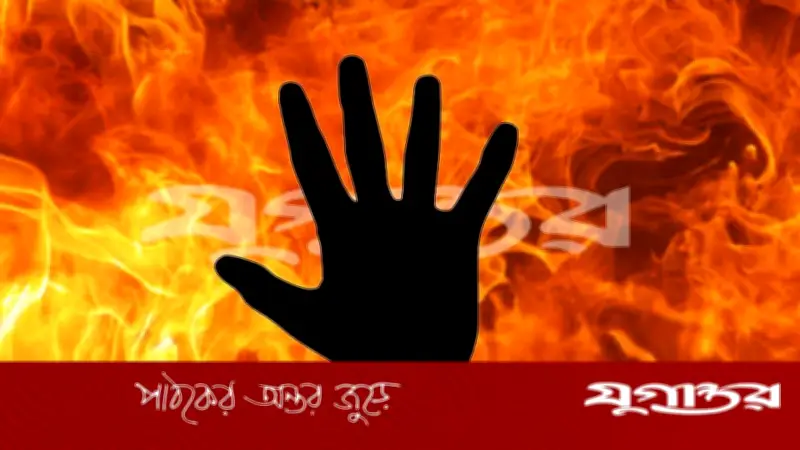 রাজধানীর হাজারীবাগে গ্যাস লিকেজে বিস্ফোরণ: শিশুসহ একই পরিবারের চারজন দগ্ধ