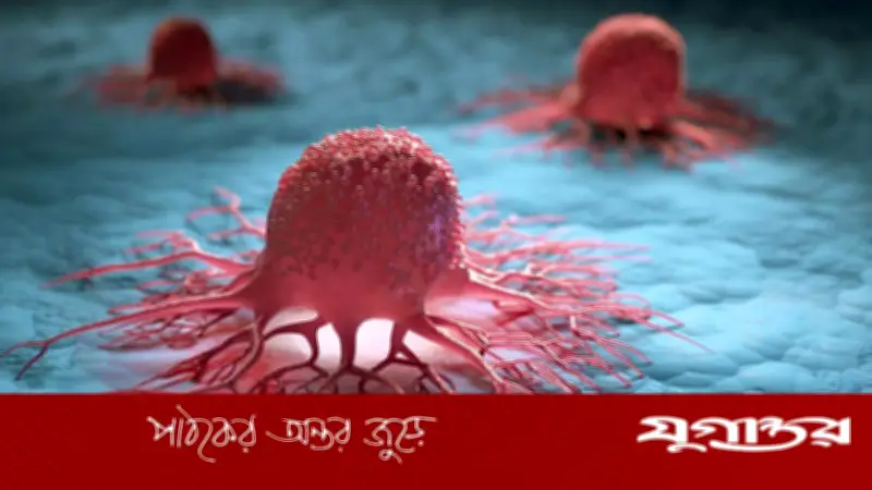 ক্যানসারের ঝুঁকি বাড়ায় শুধু দুই খাবার: প্রক্রিয়াজাত মাংস ও অ্যালকোহল