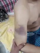 গাইবান্ধার পুনর্বাসনকেন্দ্রে মানসিক ভারসাম্যহীন যুবকের মারধর ও নির্যাতনের অভিযোগ