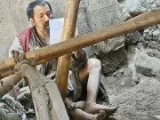 দারিদ্র্যের শিকলে বন্দী হাসান সরকার: একসময়ের মেধাবী শিক্ষার্থীর করুণ পরিণতি