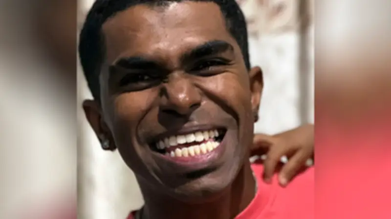 গিনেস রেকর্ডধারী প্রথাব মুনিয়ান্ডি: যার মুখে ৪২টি দাঁত, জানুন হাইপারডনশিয়ার রহস্য