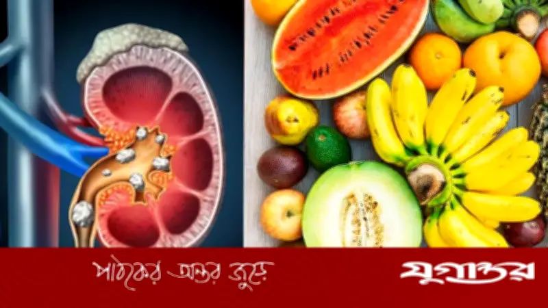 কিডনির পাথর দূর করতে উপকারী ফল: সাইট্রাস ও জলসমৃদ্ধ ফলের ভূমিকা