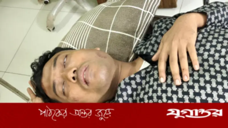 লক্ষ্মীপুরে যুবককে পেটানো ও রগ কাটার অভিযোগ, বহিষ্কৃত যুবদল নেতা হুমায়ুন কবিরের বিরুদ্ধে