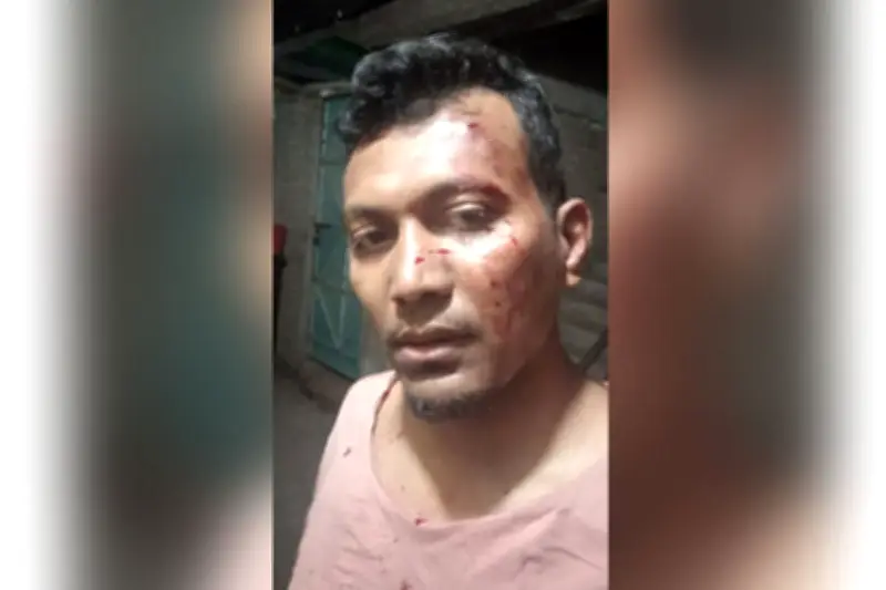 মিরপুরে সাবেক ছাত্রদল নেতা ইমরান হোসাইনের ওপর হামলা, স্বতন্ত্র প্রার্থীর পক্ষে কাজের অভিযোগ