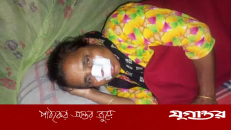 ঠাকুরগাঁওয়ে বন্য প্রাণীর আক্রমণ: গৃহবধূ জখম, প্রাণীর পরিচয় নিয়ে বিতর্ক