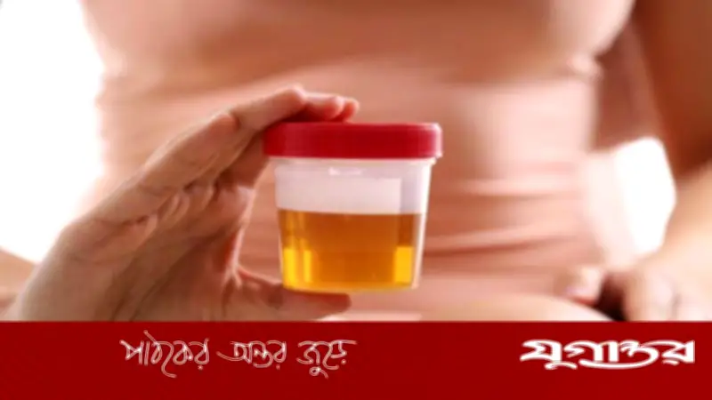 হলুদ প্রস্রাব কি ডায়াবিটিসের লক্ষণ? চিকিৎসকদের ব্যাখ্যা
