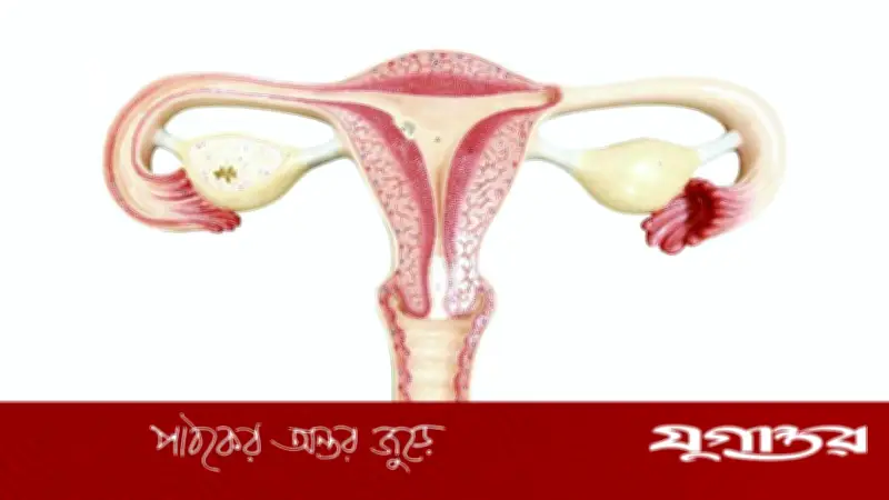 ২১ কেজি ওজনের জরায়ুর টিউমার অস্ত্রোপচারে প্রাণ বাঁচল এক মহিলার