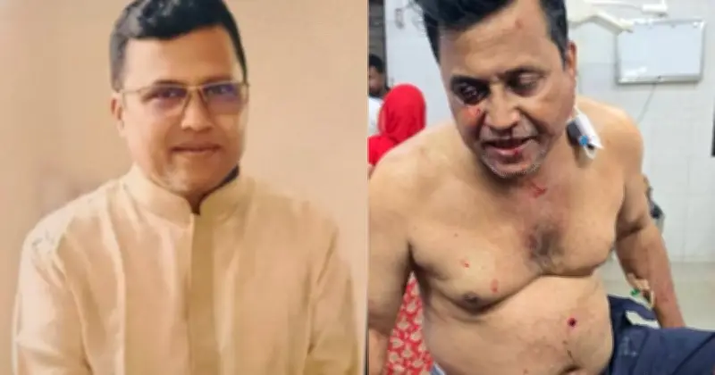 কুষ্টিয়ার মিরপুরে আওয়ামী লীগ নেতা শফিকুল ইসলাম আজম দুর্বৃত্তের গুলিতে গুরুতর আহত