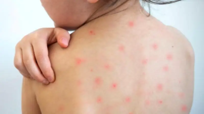 ইরানে মার্কিন ক্ষেপণাস্ত্র হামলা, স্কুল-স্পোর্টস হলে নিহত ২১, বিচারপতি পদত্যাগ