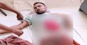 ঝিনাইদহের সীমান্তে বিএসএফের গুলিতে বাংলাদেশি যুবক আহত, যশোরে চিকিৎসাধীন