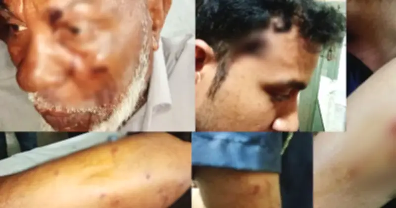 পদ্মা নদীতে নৌ পুলিশের ওপর সন্ত্রাসী হামলা: ওসি সহ ৫ জন গুলিবিদ্ধ