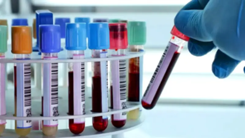 বরিশালের দুই পুলিশ সদস্য ডোপ টেস্টে পজিটিভ