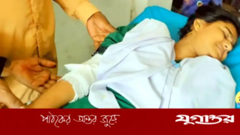 এসএসসি পরীক্ষার্থীর হাত ভেঙে দিলেন চাচা, হাসপাতালে ভর্তি কিশোরী