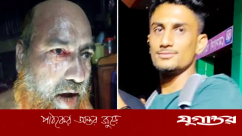 গৃহকর্তার চোখে আঙুল খোঁচা দিয়ে চুরি করে পালাল চোর