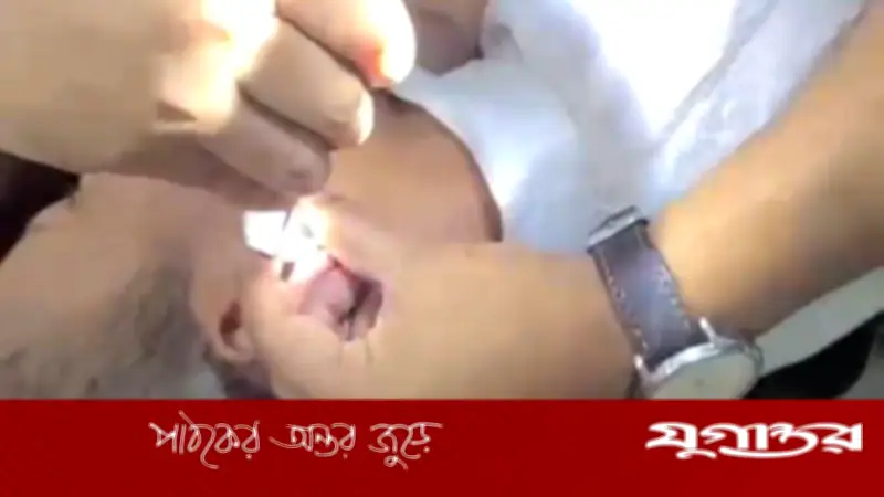 কানের ভেতর ইয়াবা লুকিয়ে, ৯ দিন পর অস্ত্রোপচারে উদ্ধার