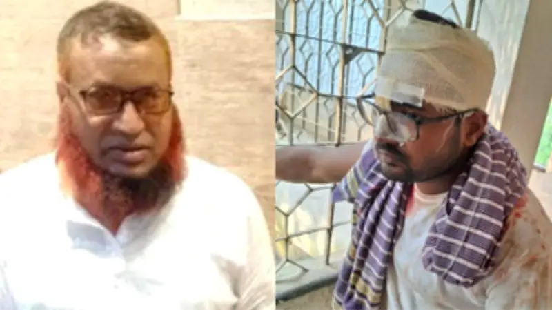 ছোট ভাইয়ের হামলায় বড় ভাই নিহত, অবস্থা আশঙ্কাজনক