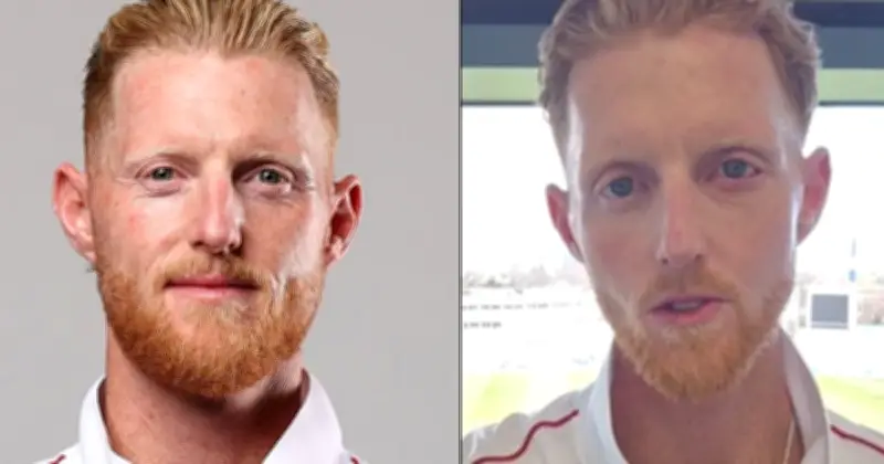 বেন স্টোকসের চেহারা বদলে গেছে ভয়ংকর ইনজুরির পর