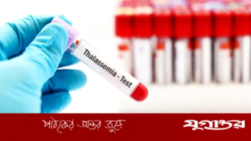 থ্যালাসেমিয়া: ভবিষ্যৎ প্রজন্মের জন্য বড় হুমকি, প্রতিরোধে করণীয়