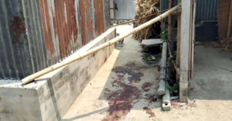 ফরিদপুরে হাত-পা বিচ্ছিন্নের ঘটনায় মামলা, আশঙ্কাজনক অবস্থায় ভাইরা