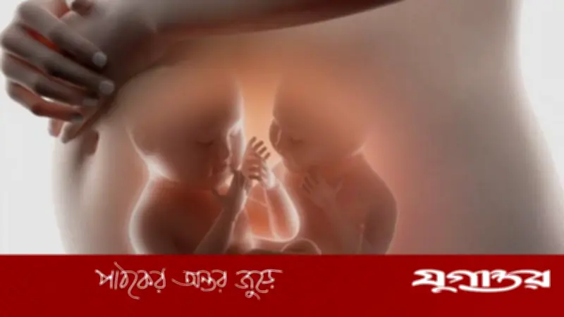 যমজ গর্ভধারণ: কারণ, লক্ষণ ও করণীয় সম্পর্কে বিস্তারিত জানুন