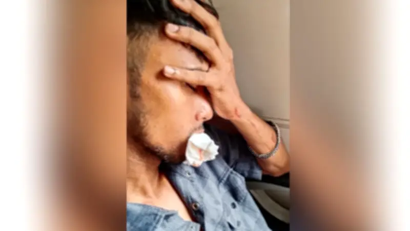 কক্সবাজার এক্সপ্রেসে পাথর নিক্ষেপে আহত দুই যাত্রী, দাঁত ভাঙল একজনের