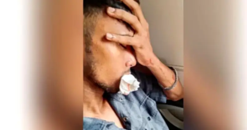 কক্সবাজার এক্সপ্রেসে পাথর নিক্ষেপে দুই যাত্রী আহত, একজনের চার দাঁত ভাঙল