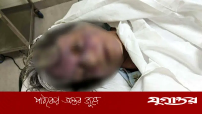 গুলশানে বিদেশি নাগরিককে পিটিয়ে হত্যা, তদন্ত চলছে