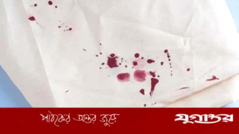 মাছের রক্তে কাপড় অপবিত্র হয় কি? ইসলামী বিধান জানুন