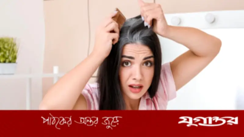 কম বয়সে চুল পাকা: কারণ ও প্রতিকার নিয়ে বিশেষজ্ঞরা যা বলছেন