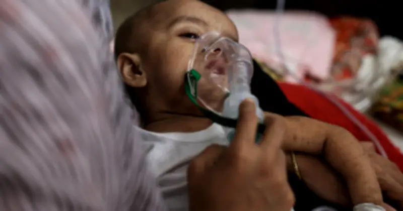 বাংলাদেশে হাম আক্রান্ত শিশুদের ৭৪% টিকা নেয়নি: স্বাস্থ্য অধিদপ্তর