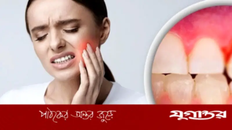 মাড়ির ছোট সমস্যা বড় রোগের ইঙ্গিত হতে পারে