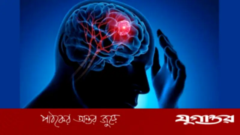 মস্তিষ্কের টিউমারের ৭টি গুরুত্বপূর্ণ লক্ষণ: সতর্ক থাকুন, অবহেলা করবেন না