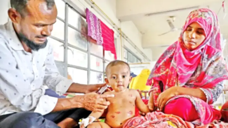 বাংলাদেশে হাম টিকা কর্মসূচি ও মার্চে সড়ক দুর্ঘটনায় ৬১৯ জনের মৃত্যু