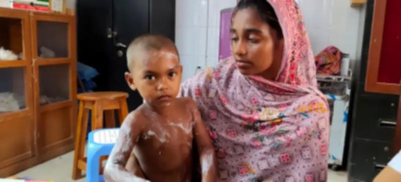 টাঙ্গাইলের সখীপুরে কার্বলিক অ্যাসিডে শিশু দগ্ধ: নিরাপত্তা সচেতনতার জরুরি আহ্বান