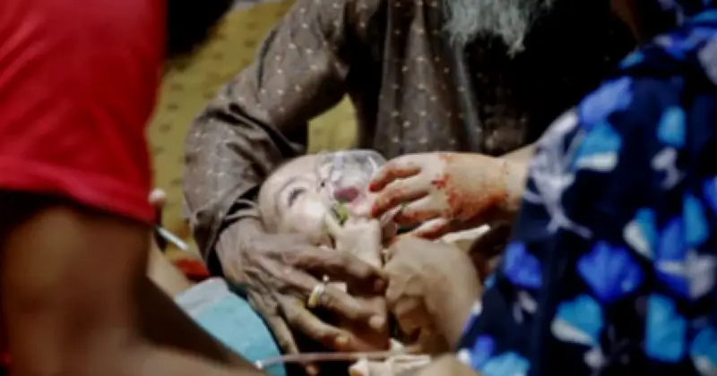 হামের সংক্রমণে দেশজুড়ে আতঙ্ক: শিশু হাসপাতালে ভিড়, জরুরি টিকাদান শুরু