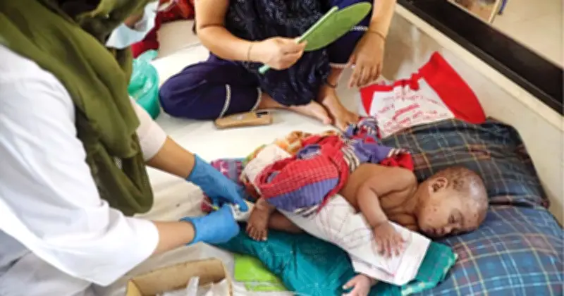 দেশে হামের প্রাদুর্ভাব: ২০ দিনে ১০৩ শিশুর মৃত্যু, ৫ হাজার ৮১২ আক্রান্ত