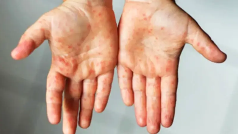 হামে শিশু মৃত্যু ও সংসদে বিল পাস: এক দিনের গুরুত্বপূর্ণ খবর