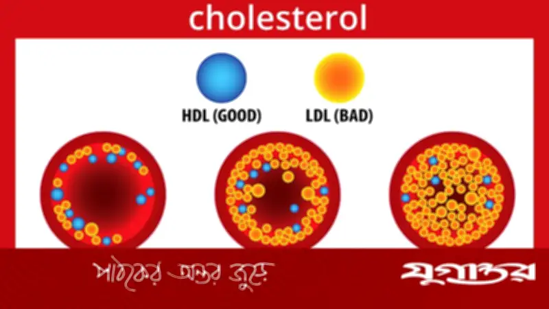ক্ষতিকর কোলেস্টেরল কমানোর কার্যকরী উপায়: হৃদরোগের ঝুঁকি কমাতে প্রাকৃতিক পদ্ধতি