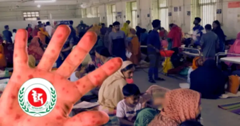 গত ২৪ ঘণ্টায় হামে ১০ জনের মৃত্যু, আক্রান্ত শিশুর সংখ্যা বেড়ে ১,২৩৬