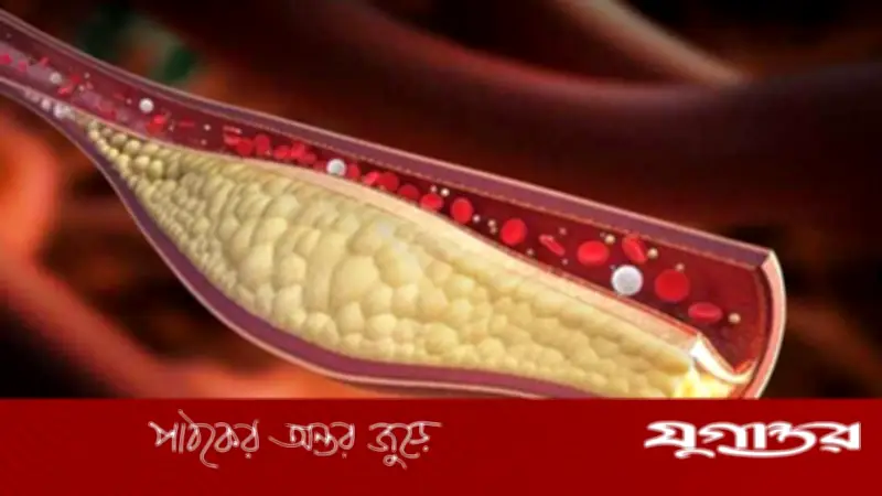 কোলেস্টেরল নিয়ন্ত্রণে সহজ ঘরোয়া উপায়: ওটমিল ও কাঠবাদামের মিশ্রণ