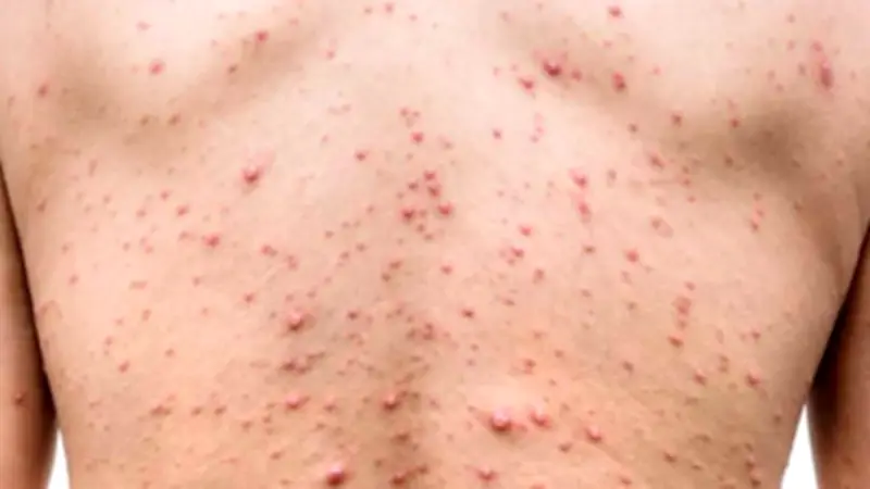 কুমিল্লায় হামলায় চার মৃত্যু, স্বেচ্ছাসেবক লীগ নেতা গ্রেপ্তার; বিএনপির নারী আসনে ৫৪৪ ফরম বিক্রি