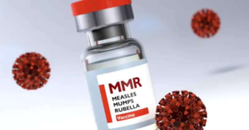 হামের প্রাদুর্ভাব মোকাবিলায় চার সিটিতে বিশেষ টিকাদান কার্যক্রম শুরু