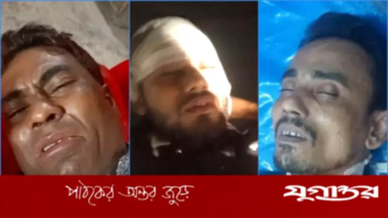 ফেনীর সোনাগাজীতে বিএনপির দুই গ্রুপের সংঘর্ষে ৫ জন আহত, তিনজন আটক