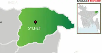 সিলেটে হামের লক্ষণে শিশুর মৃত্যু, আক্রান্তের সংখ্যা বাড়ছে