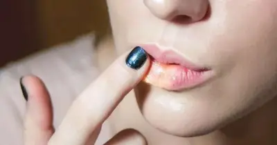 গরমে ঠোঁট ফাটার সমস্যা: কারণ, প্রতিকার ও বিশেষজ্ঞ পরামর্শ