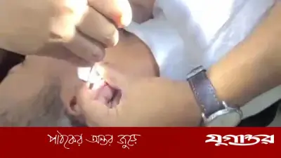 কানের ভেতর ইয়াবা লুকিয়ে, ৯ দিন পর অস্ত্রোপচারে উদ্ধার