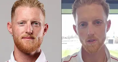 বেন স্টোকসের চেহারা বদলে গেছে ভয়ংকর ইনজুরির পর