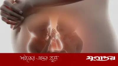 যমজ গর্ভধারণ: কারণ, লক্ষণ ও করণীয় সম্পর্কে বিস্তারিত জানুন