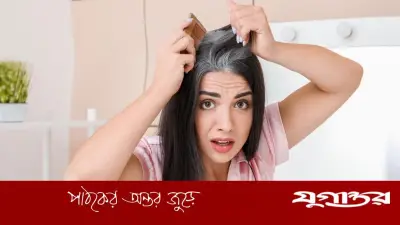 কম বয়সে চুল পাকা: কারণ ও প্রতিকার নিয়ে বিশেষজ্ঞরা যা বলছেন